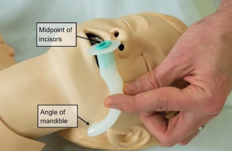 How to use an oral airway